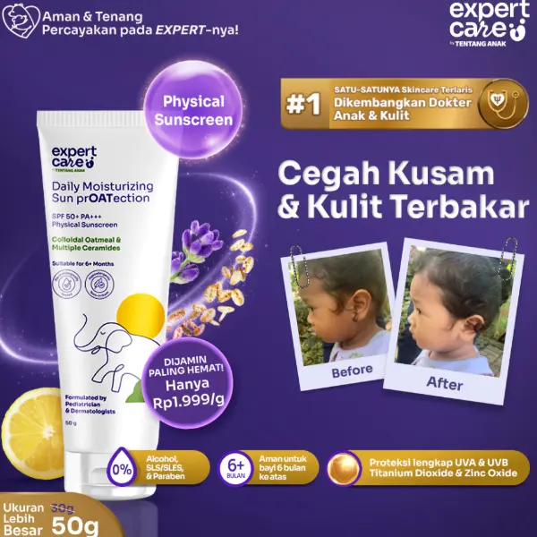 Rekomendasi Sunscreen Anak